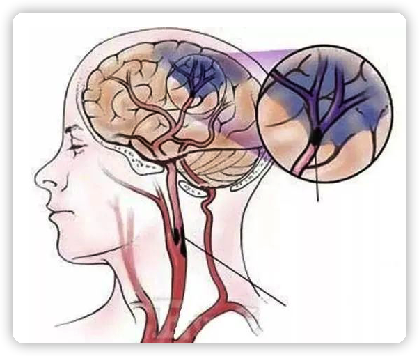 1654065790136057.png 640 (20).png